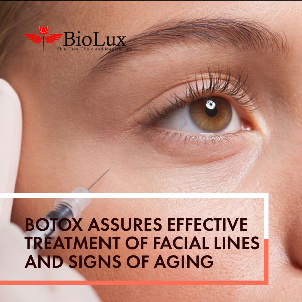 Botox Assures Effective Treatment Of Facial Lines And Signs Of Aging